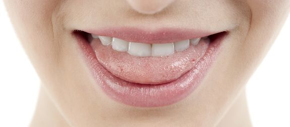 Halitosis